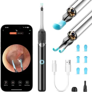 Ear Wax Removal Kit - 2-in-1 Visual Otoscope - Ear Cleaner Tweezers with 6 Ear Spoon - Earwax Removal Kit with Light - Ear Cleaner with Camera - Ear Cleaner for iOS & Android (Black)